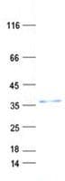 Human VAX2 Protein (Recombinant His, N-Terminal)