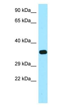 Polyclonal Rabbit anti-Human FBP / FOLR2 Antibody (aa182-231, WB)