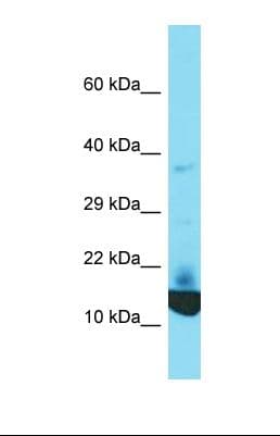 KRTCAP2 Antibody (C-Terminus)