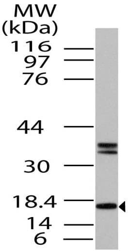 Polyclonal Rabbit anti-Human FABP7 / BLBP / MRG Antibody (aa1-321, WB)