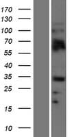 OLIG2 Protein (Over-Expression Lysate Myc-DDK (Flag))
