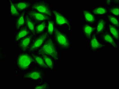 Polyclonal Rabbit anti-Human INTS6 Antibody (IF)