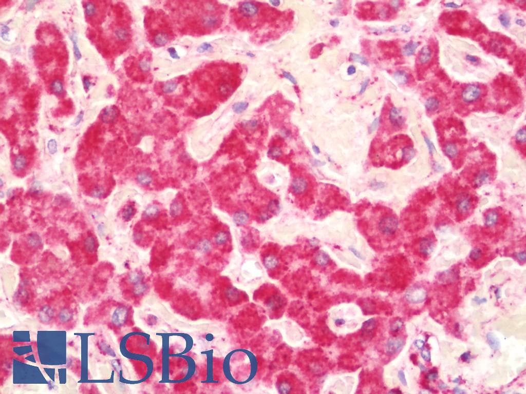 IHC-plus™ UQCRC1 Antibody (clone 1G6)