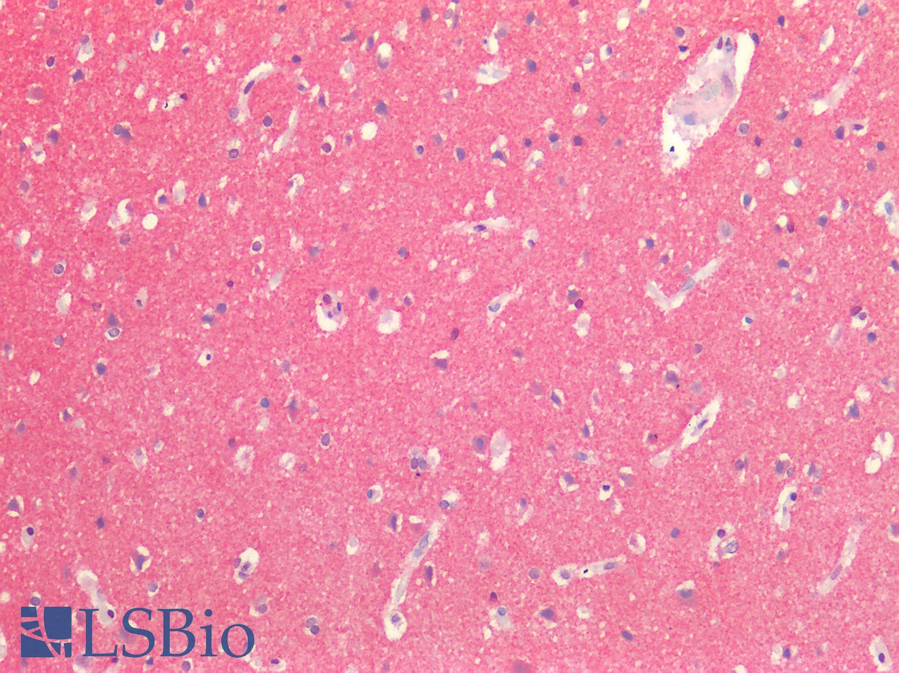 IHC-plus™ SYP / Synaptophysin Antibody
