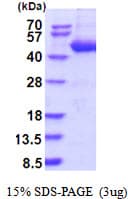 Human SERPINB4 / SCCA1+2 Protein (Recombinant His)