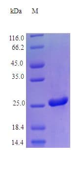 Human LGALS3 / Galectin 3 Protein (Recombinant)