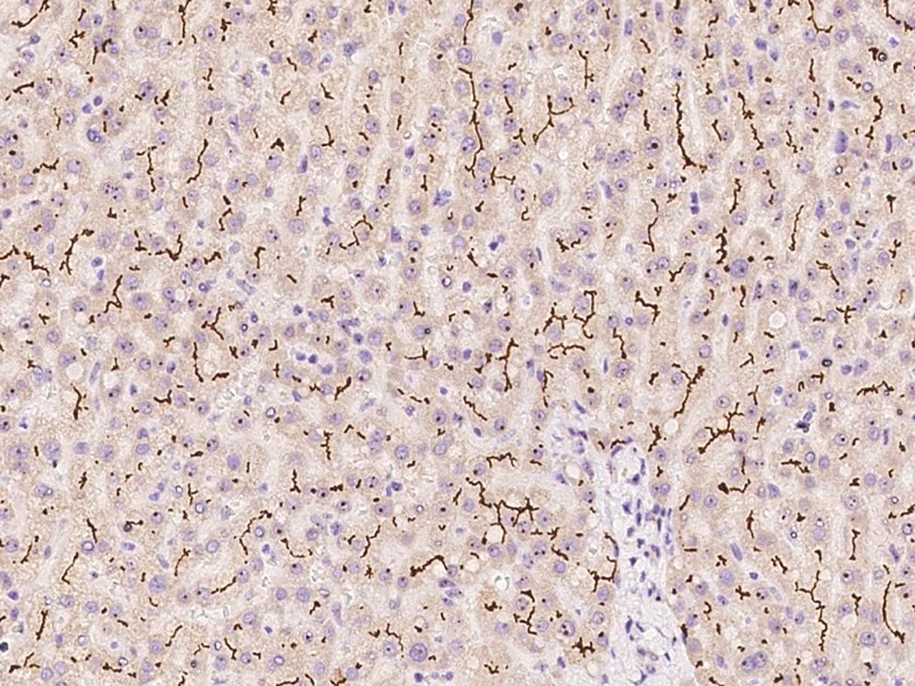 ABCC2 / MRP2 Antibody