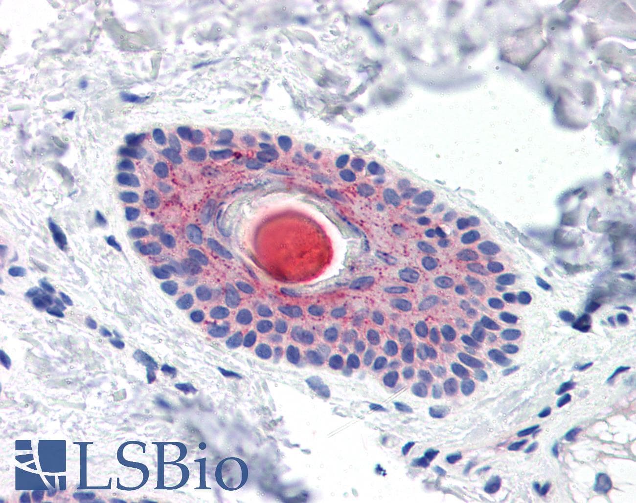 IHC-plus™ Polyclonal Rabbit anti-Human C4.4A / LYPD3 Antibody (C-Terminus, IHC)