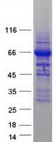Human ACS5 / ACSL5 Protein (Recombinant Myc-DDK (Flag))