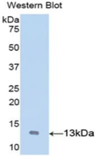 VWF / Von Willebrand Factor Antibody (aa269-367)
