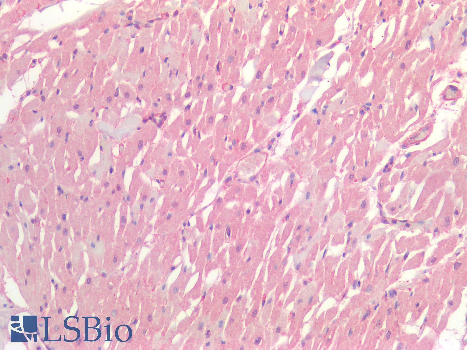 IHC-plus™ HSPB1 / HSP27 Antibody