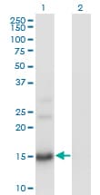 BTG2 Antibody (clone 1A5)