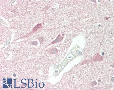 IHC-plus™ MAPT / Tau Antibody (C-Terminus)