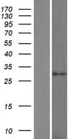 LGALS12 / Galectin 12 Protein (Over-Expression Lysate Myc-DDK (Flag))