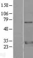Human YWHAZ / 14-3-3 Zeta Protein (Over-Expression Lysate Myc-DDK (Flag))
