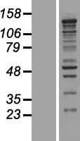 CASZ1 Protein (Over-Expression Lysate Myc-DDK (Flag))
