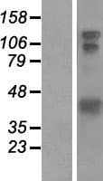 Human HOMER1 / Homer 1 Protein (Over-Expression Lysate Myc-DDK (Flag))