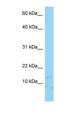 LAMA4 / Laminin Alpha 4 Antibody (C-Terminus)