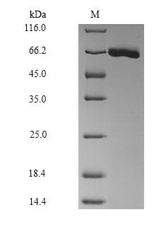 Mouse ALB / Serum Albumin Protein (Recombinant 9His, C-terminus)
