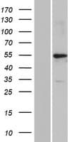 KRT39 / Cytokeratin 39 Protein (Over-Expression Lysate Myc-DDK (Flag))