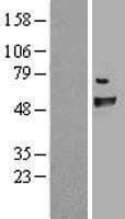 Human FANCC Protein (Over-Expression Lysate Myc-DDK (Flag))