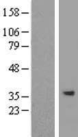 SPG21 / MAST Protein (Over-Expression Lysate Myc-DDK (Flag))