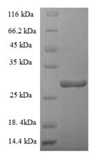 Human CSF2 / GM-CSF Protein (Recombinant GST, N-terminus)