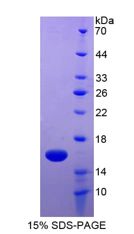 Human CD66c / CEACAM6 Protein (Recombinant His-T7)