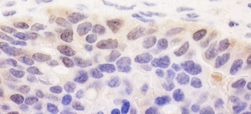 SPATA2 Antibody (aa250-300)