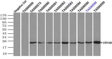 Monoclonal Mouse anti-Human CRYAB / Alpha B Crystallin Antibody (clone OTI4G5, IHC, WB)