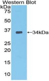 PDPK1 / PDK1 Antibody (aa83-338)