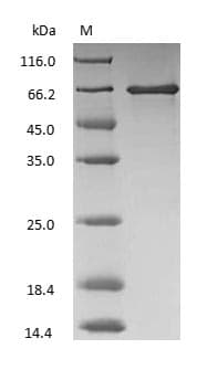 ALB / Serum Albumin Protein (Native)