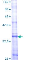Human NEP / DDR1 Protein (Recombinant GST, N-terminus)