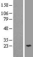 YKT6 Protein (Over-Expression Lysate Myc-DDK (Flag))