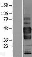 Human LYVE1 Protein (Over-Expression Lysate Myc-DDK (Flag))