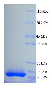Rhesus monkey IL15 Protein (Recombinant 6His, N-terminus)