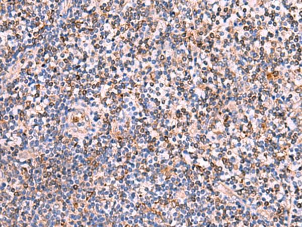 Polyclonal Rabbit anti-Human SOX2 Antibody (IHC, WB)