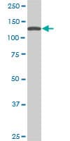 SF3B2 Antibody (clone 5D2)
