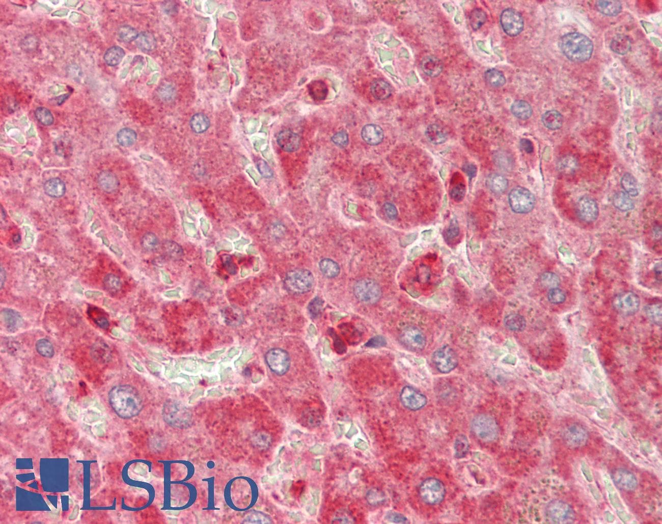MYL6 Antibody (N-Terminus)