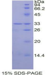 Human STAT6 Protein (Recombinant His-T7)