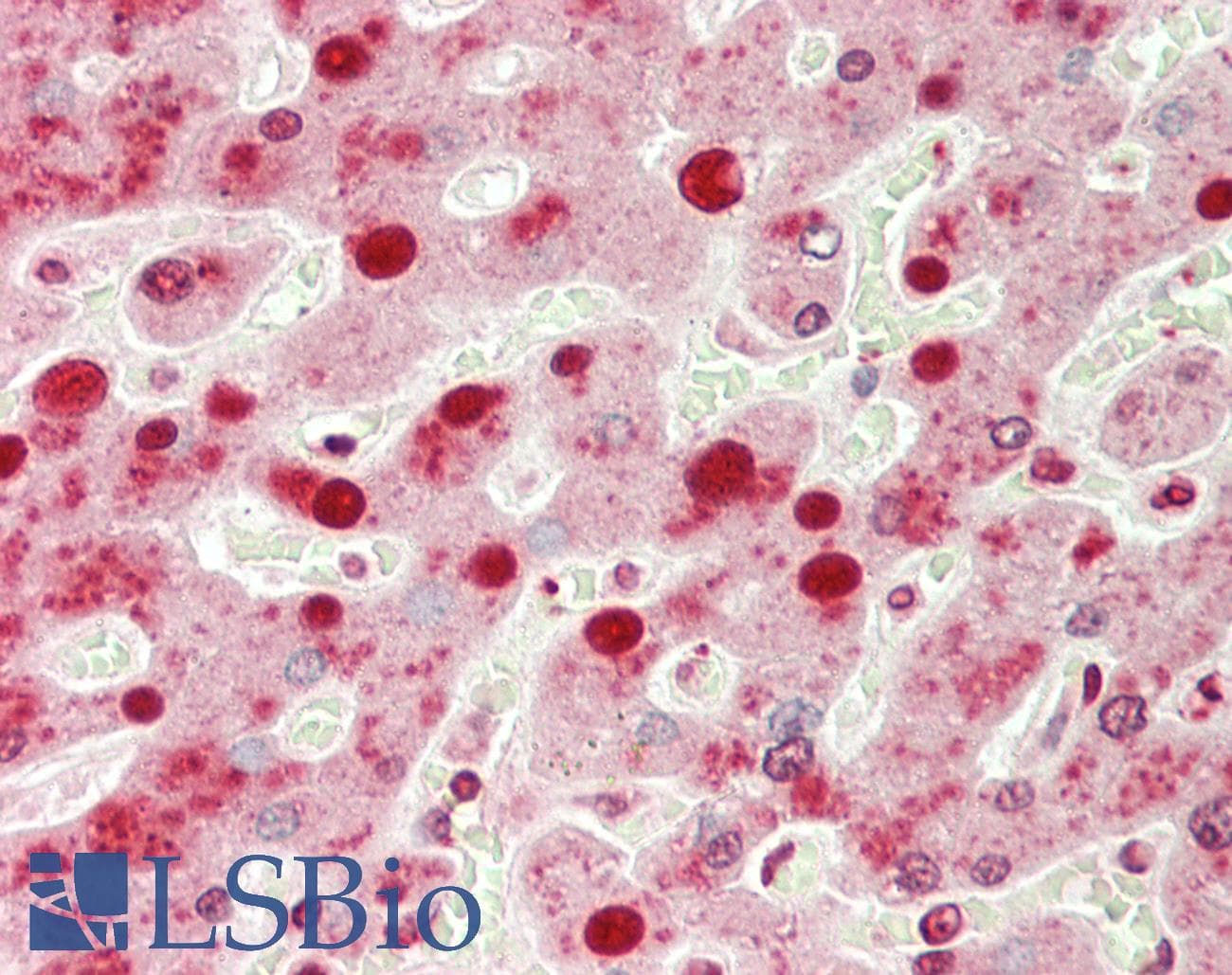 PathPlus™ ENO1 / Alpha Enolase Antibody (clone 12)