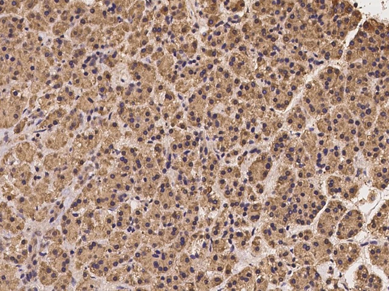 SEC23B Antibody