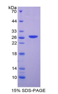 Mouse DNASE1L2 Protein (Recombinant His-T7)