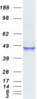Human CTSL / Cathepsin L Protein (Recombinant Myc-DDK (Flag))