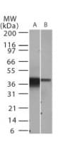 NFKBIA / IKB Alpha / IKBA Antibody (aa32-291, clone 6A920)