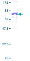 Human CFH / Complement Factor H Protein (Recombinant GST)