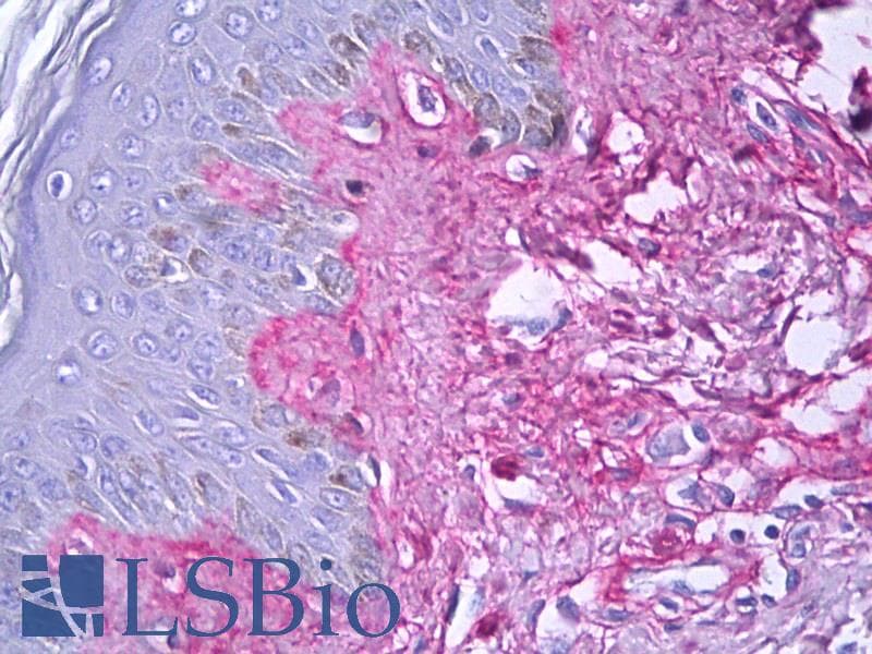 IHC-plus™ Collagen V Antibody
