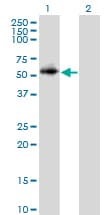 PPP2R2C Antibody (clone 6D1)