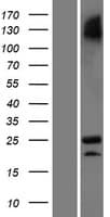 Human C3orf84 Protein (Over-Expression Lysate Myc-DDK (Flag))