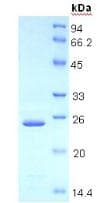 Human THBS1 / Thrombospondin-1 Protein (Recombinant His, N-Terminal)